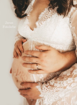 Babybauch-Shooting